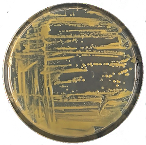 Xanthomonas campestris tenyészet táptalajon